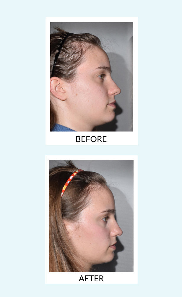 Hair Force Phyto-Serum