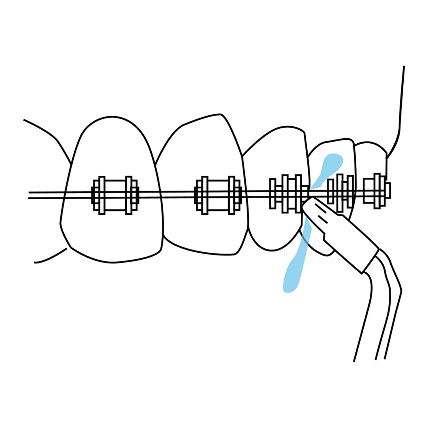 Special Tips - Oral Care Accessories